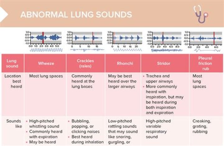 Are adventitious sounds bad?