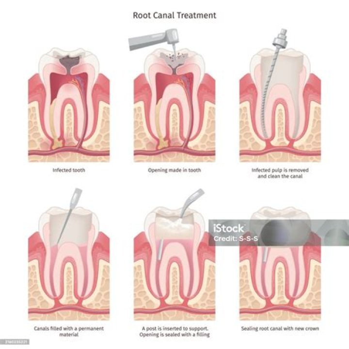 Can an rct be longitudinal?