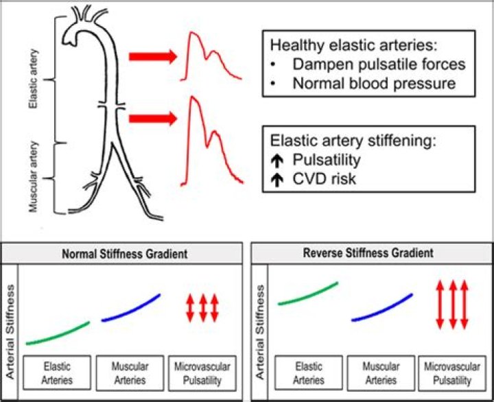 Can artery stiffening be reversed?