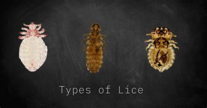 Can dogs get lice?