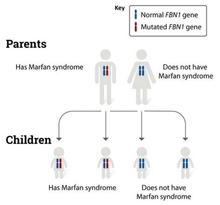 Can marfan syndrome be passed on?