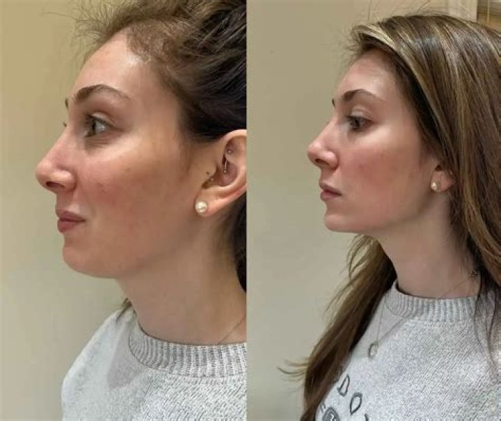 Can you accentuate jawline?