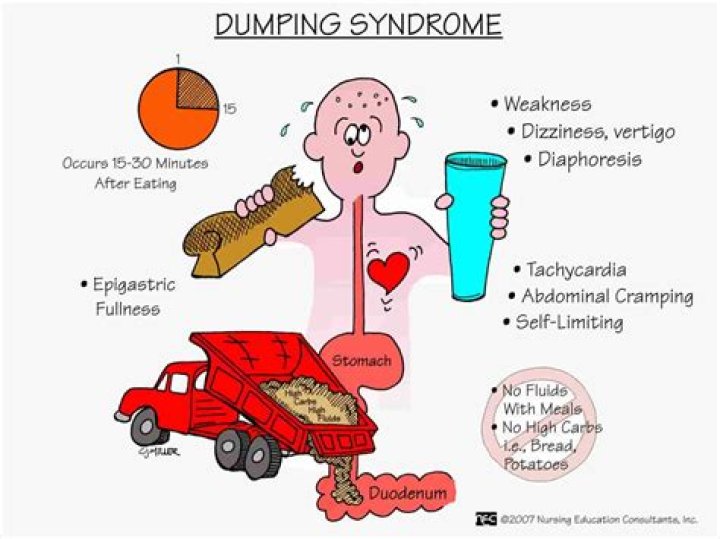 Can you die from dumping syndrome?
