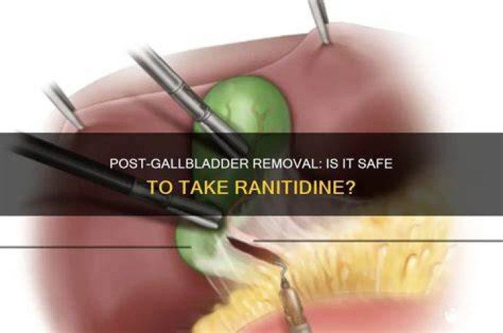 Can you take ranitidine?