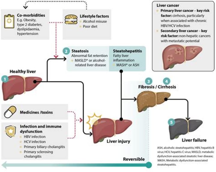 Do liver tonic work?