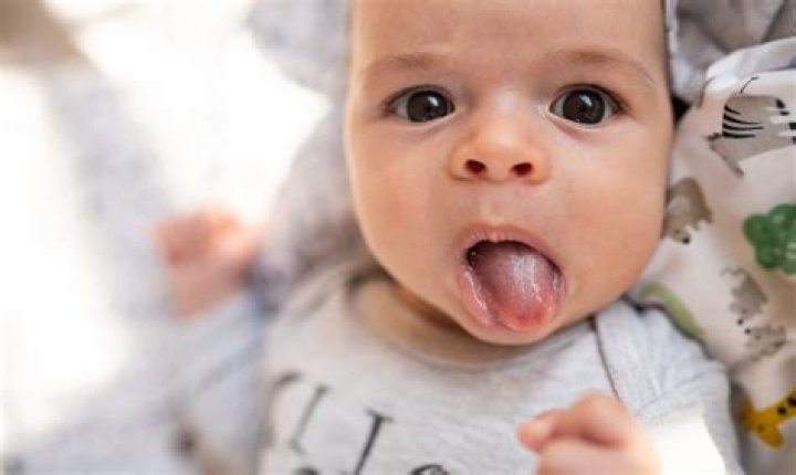 Do tongue tied babies drool more?