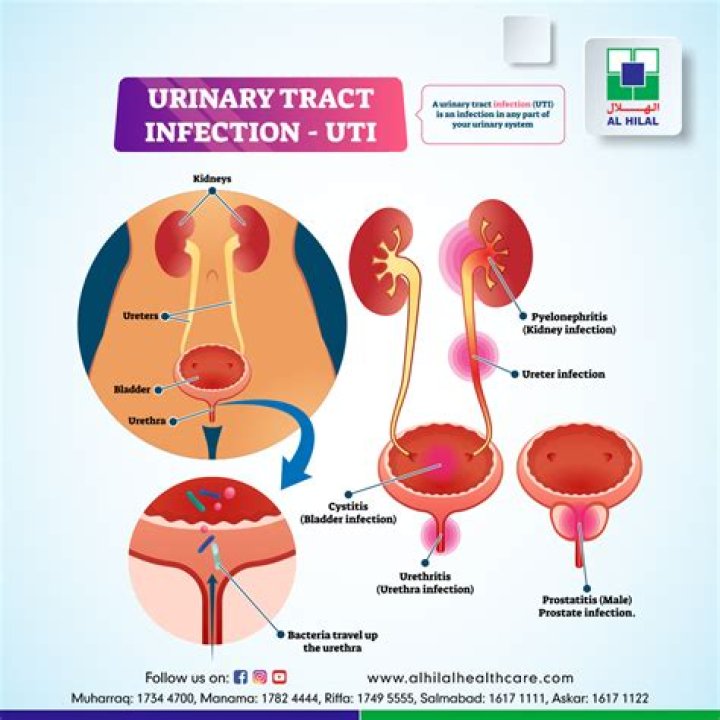 Do urinary tract infections smell?