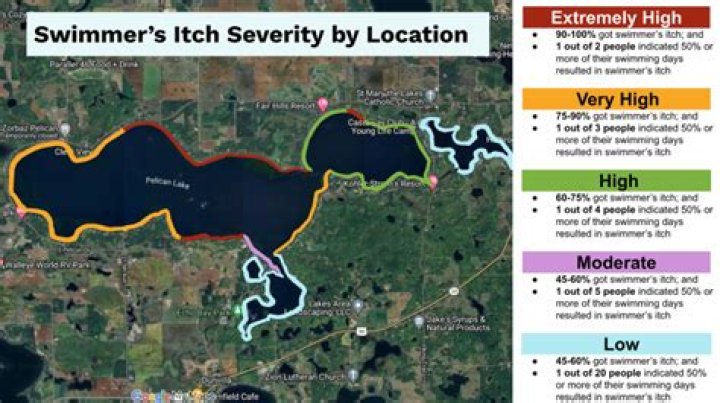 Does suttle lake have swimmer's itch?