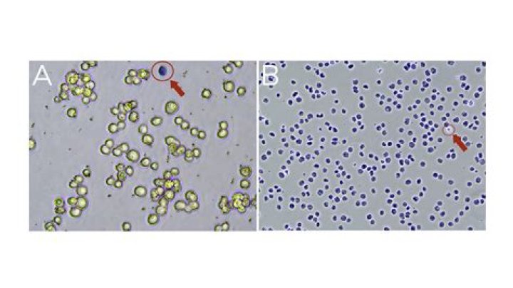 Does trypan blue kill cells?