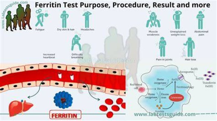How ferritin is measured?