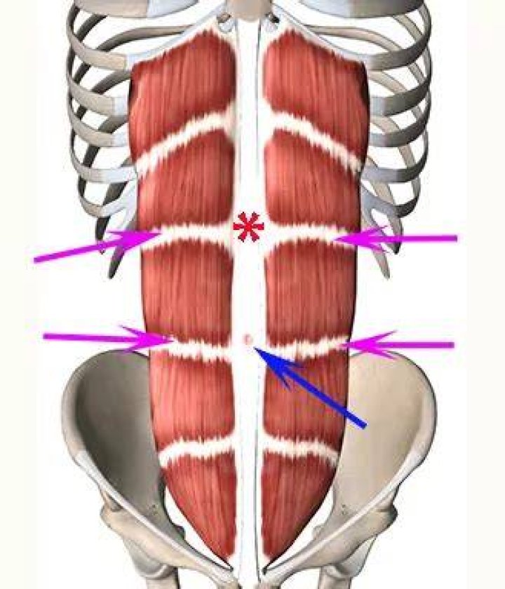 How many tendinous intersection the rectus abdominis?
