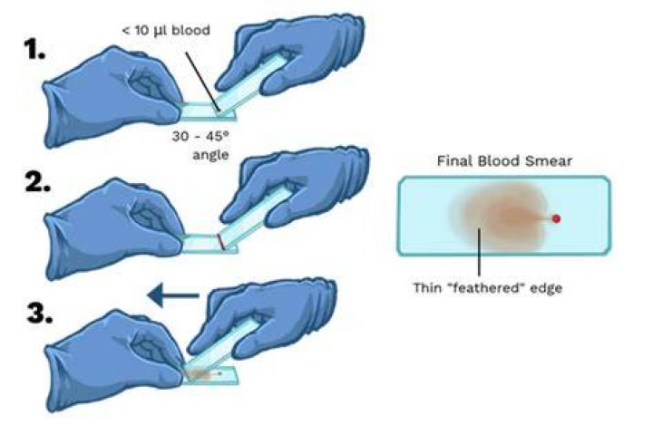How to perform a blood smear?