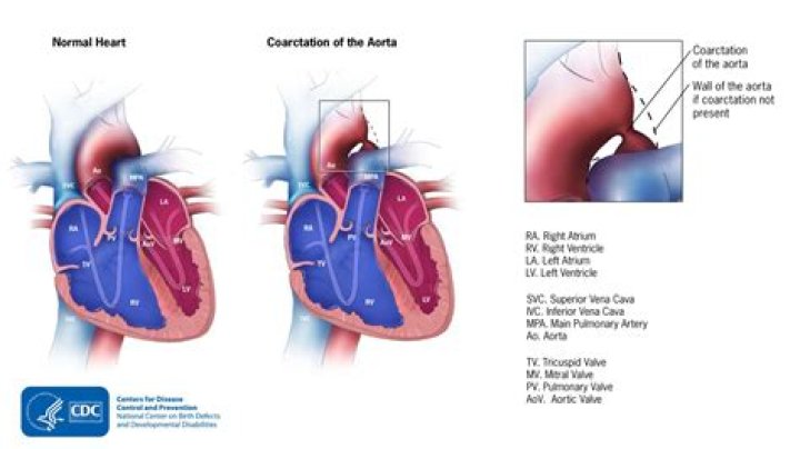How to spell cortication?