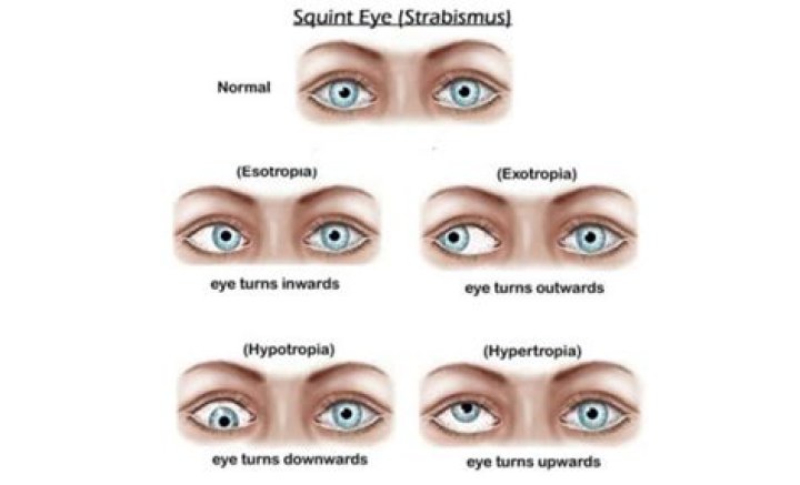 How to spell squint eyes?