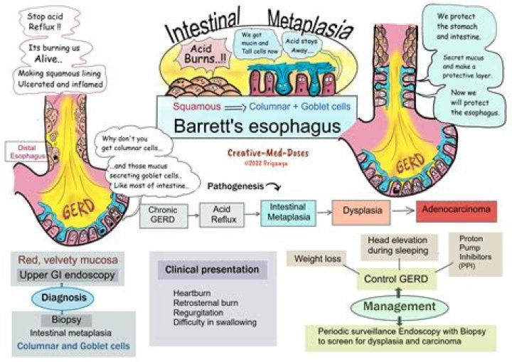 Is barrett's oesophagus reversible?