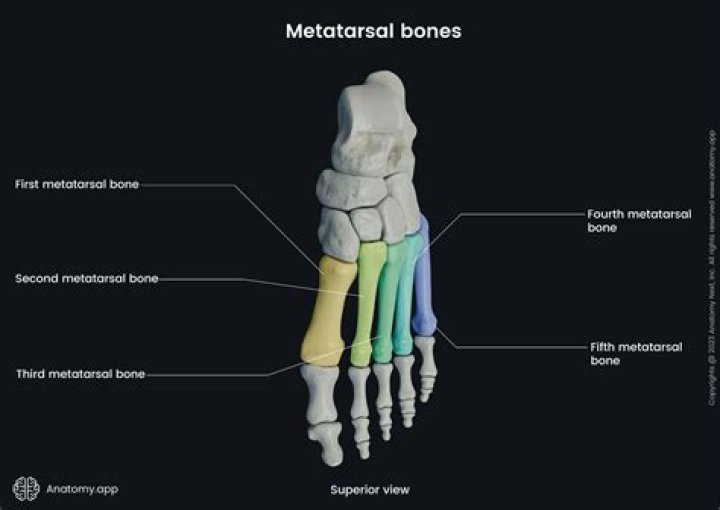 Is it metatarsus or metatarsal?