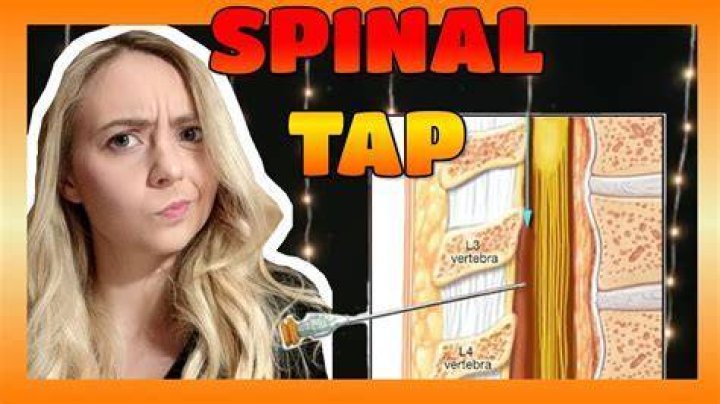Is spinal tap painful?