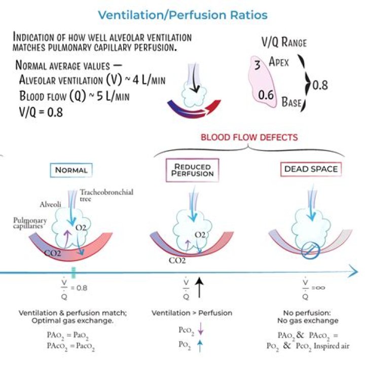 Is ventilation perfusion matching?
