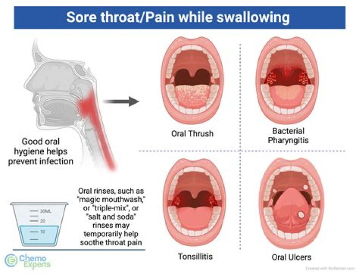 Should i get a covid test for a scratchy throat?