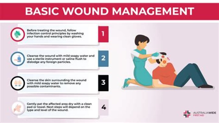 Should you take rescue remedy?