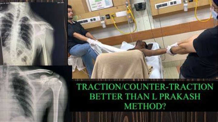 What does countertraction mean in medical terms?