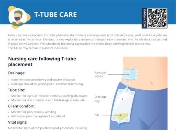 What does the medical term cholelithotomy mean?