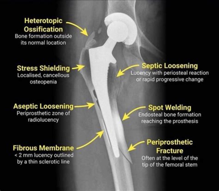 What does the word postsurgical mean?