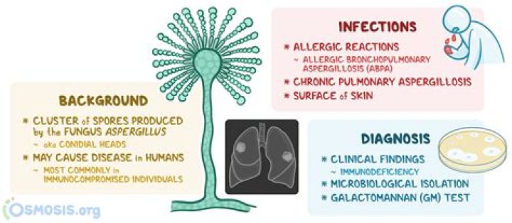 What is aspergillosis fungus?