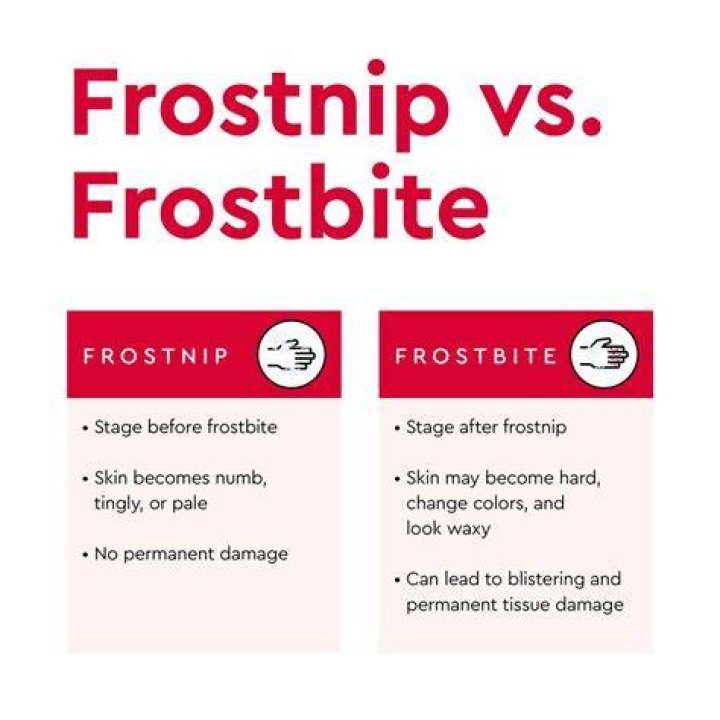 What is the difference between frostnip?