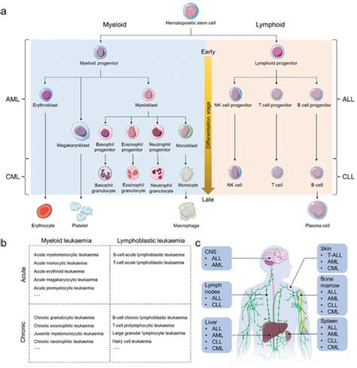 What leukocytes are involved in acute myelogenous leukemia?