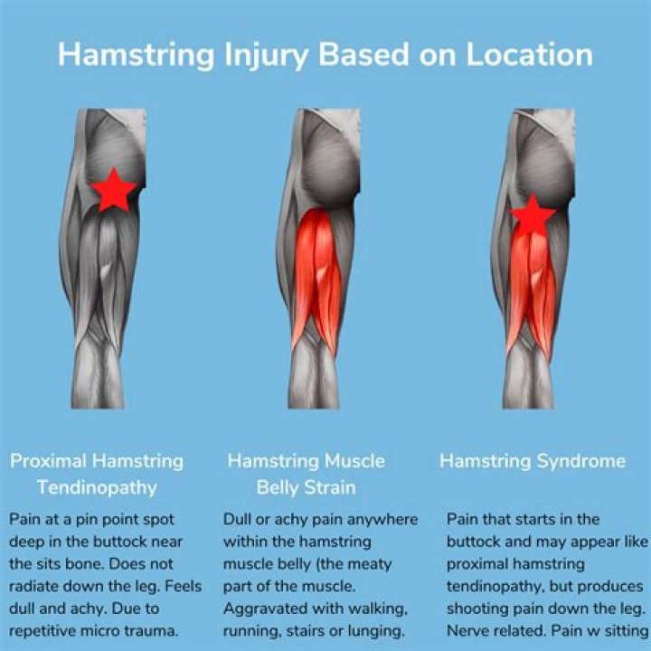 Whats a hamstring injury?