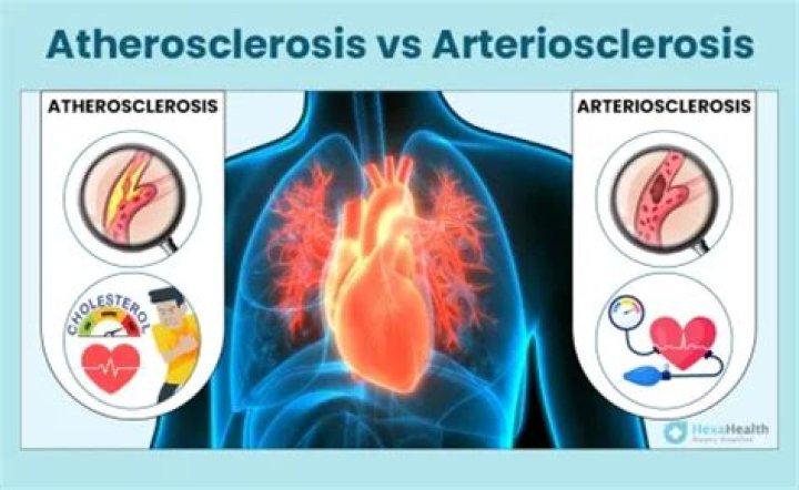 Whats the difference between arteriosclerosis?