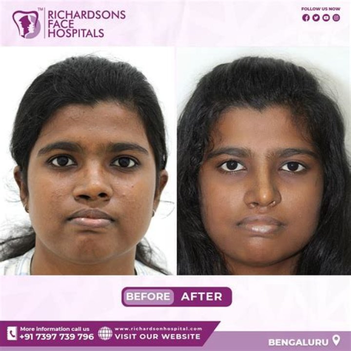 Where is richardson face hospital?