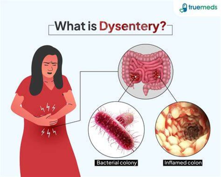 Why did dysentery kill?