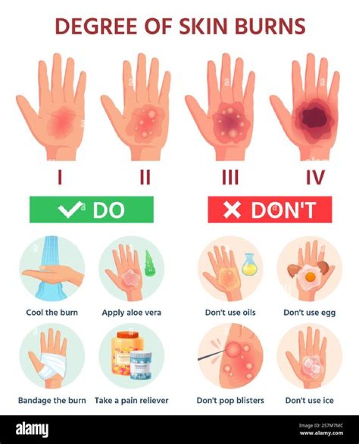 Will a blister burn scar?