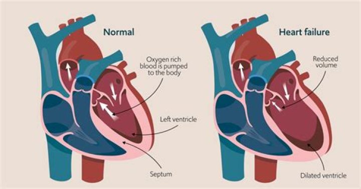 Will ekg show heart failure?